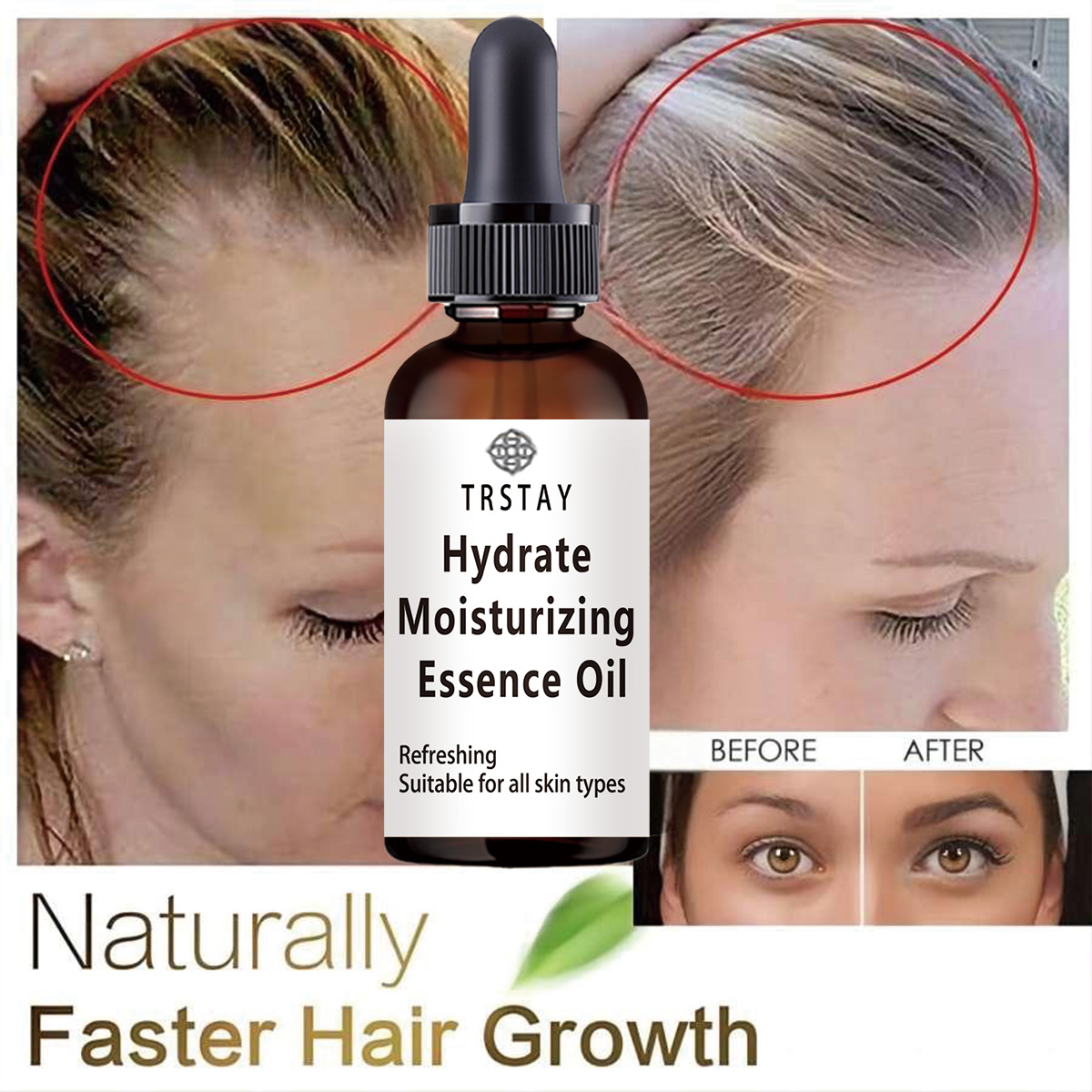 Coconut Oil Pull - جديد زيت الخروع نمو الشعر الزيوت