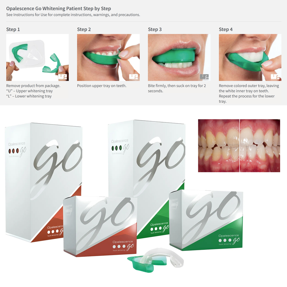 Teeth Whitening Gel Opalescence - صواني تبييض الأسنان Opalescence Go ،
