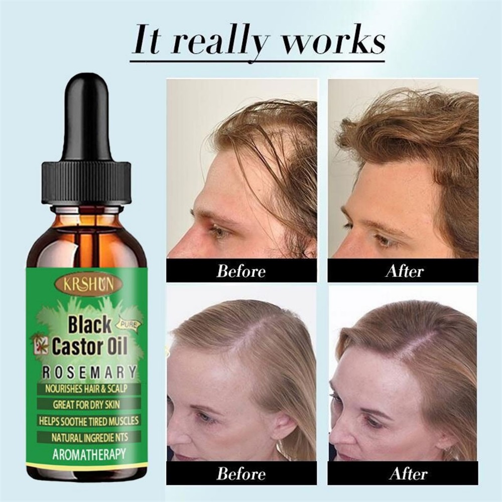 Coconut Oil Pull - زيت الخروع الأسود يغذي نمو الشعر