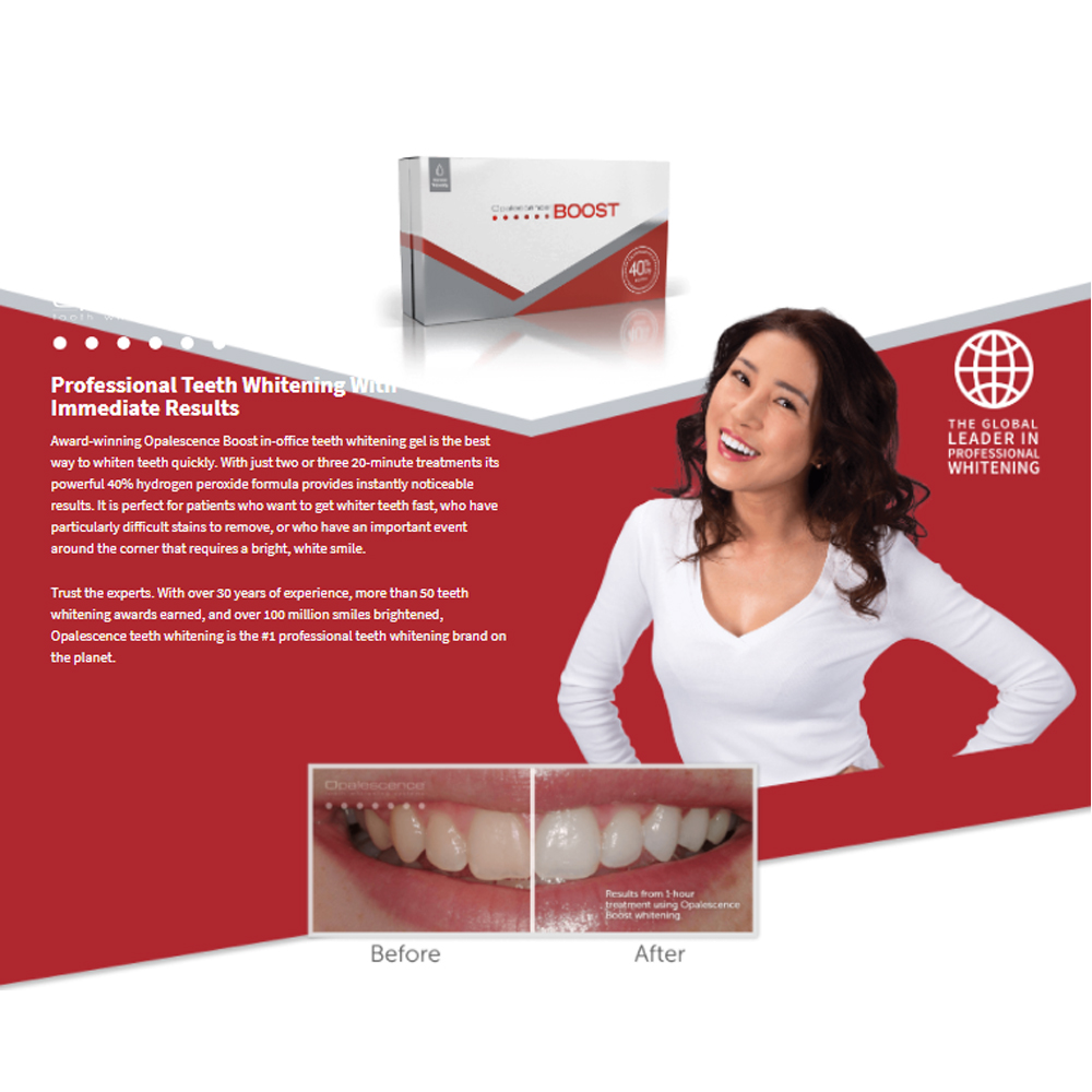 أوباليسنس بوست 40% بي إف، جل ت - مراجعة Teeth Whitening Gel Opalescence وسعره