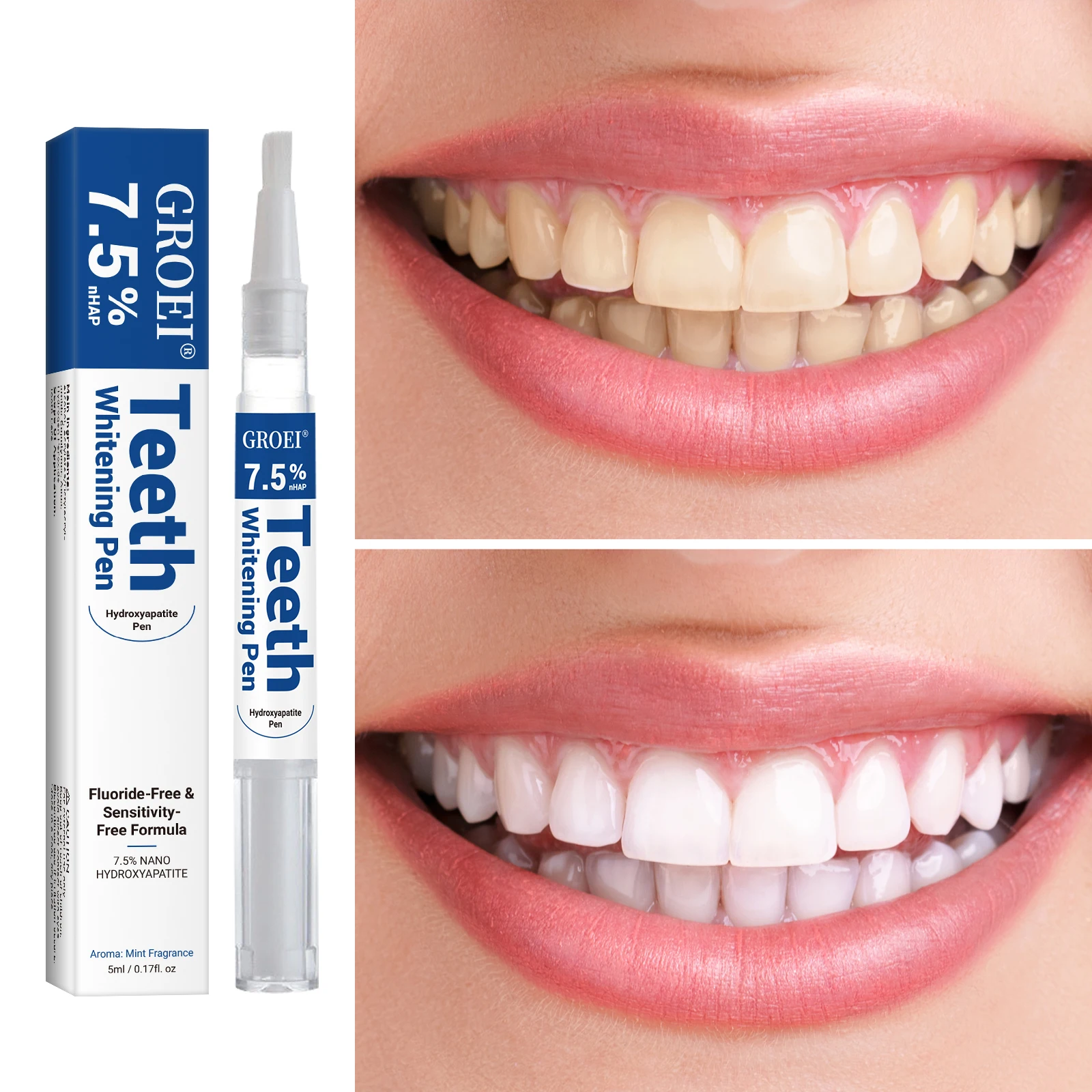 هيدروكسياباتيت تبييض الأسنان ا - مراجعة Teeth Whitening Paste وسعره