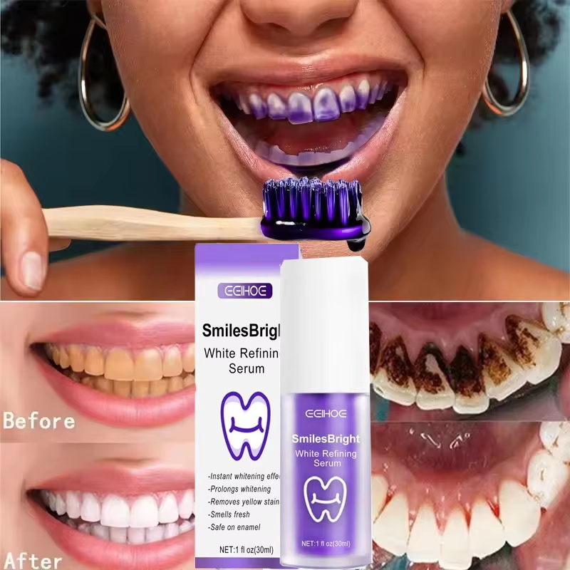 معجون أسنان لتبييض وتنظيف الأس - مراجعة Teeth Whitening In Korea وسعره
