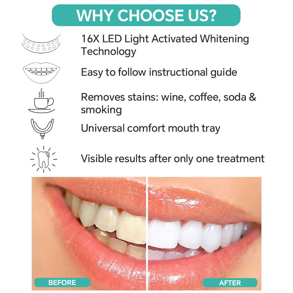 جهاز تبييض الأسنان المحمول بال - مراجعة Led Mouth Tray وسعره