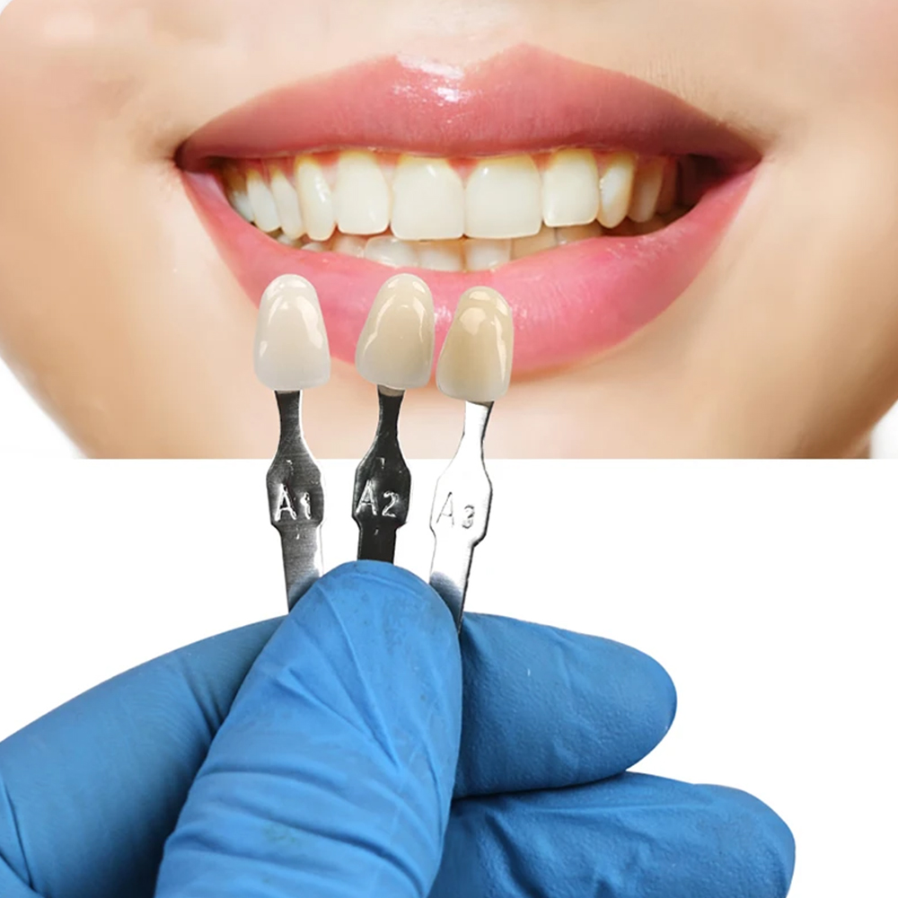 طقم تبييض وتلميع الأسنان VITA  - مراجعة Teeth Whitening Shade Guide وسعره