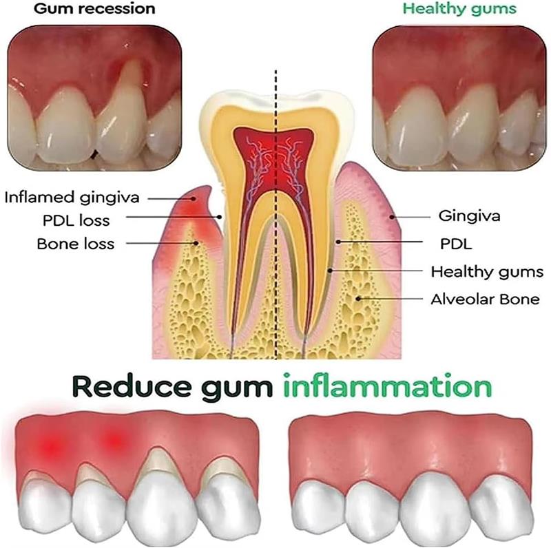 جل تبييض الأسنان للعناية باللث - مراجعة Teeth Whitening Gels وسعره