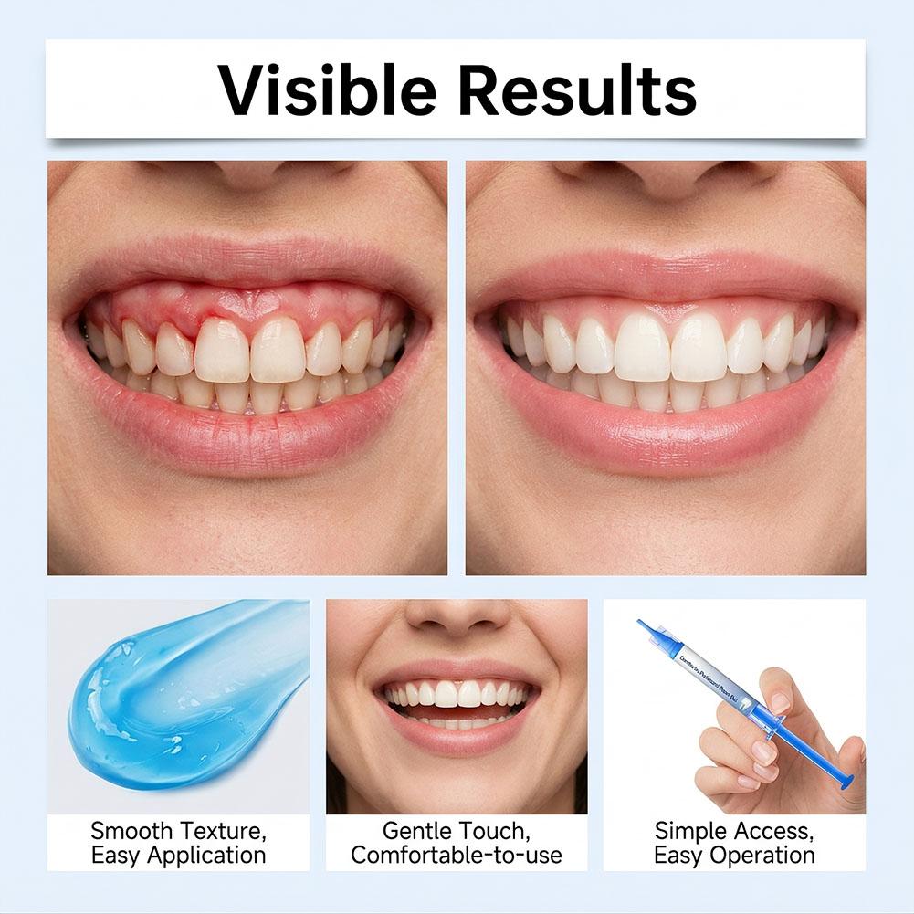 3 قطع من جل إصلاح اللثة، مزيل  - مراجعة Teeth Whitening Gels وسعره