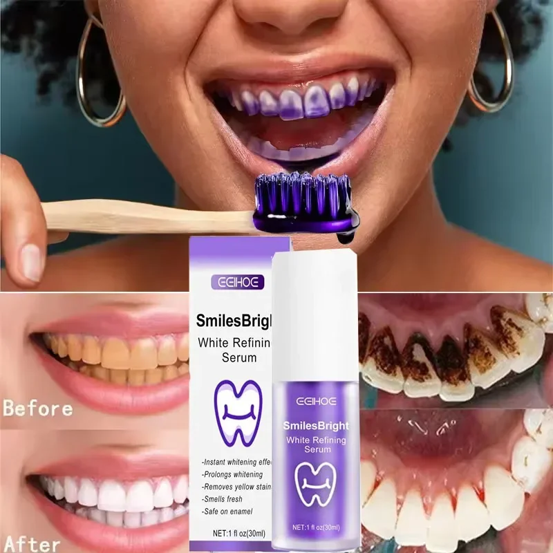 معجون أسنان مبيض لتنظيف الأسنا - مراجعة Teeth Whitening In Korea وسعره