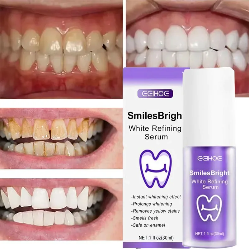 معجون أسنان مبيض لتنظيف الأسنا - مراجعة Teeth Whitening In Korea وسعره
