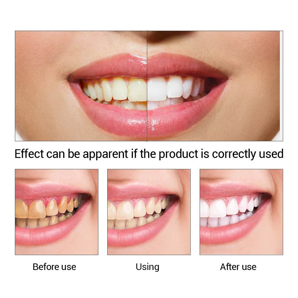 Fteenly تبييض الأسنان جوهر مسح - مراجعة Teeth Whitening Paste وسعره