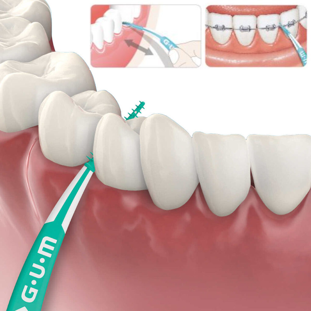 اللثة لينة يختار المتقدمة الصغ - مراجعة Teeth Whitening In Japan وسعره