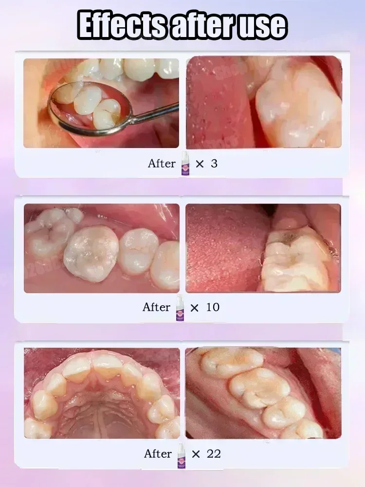معجون أسنان لتنظيف الأسنان يزي - مراجعة Teeth Whitening Toothpaste وسعره