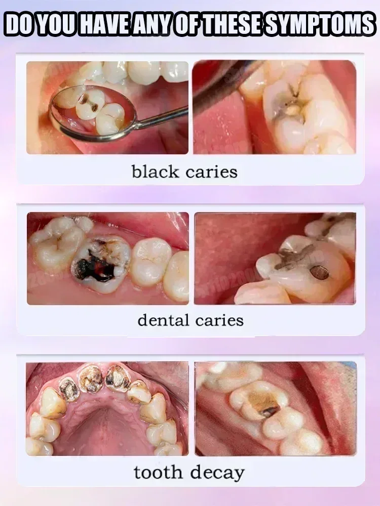 معجون أسنان لتنظيف الأسنان يزي - مراجعة Teeth Whitening Toothpaste وسعره
