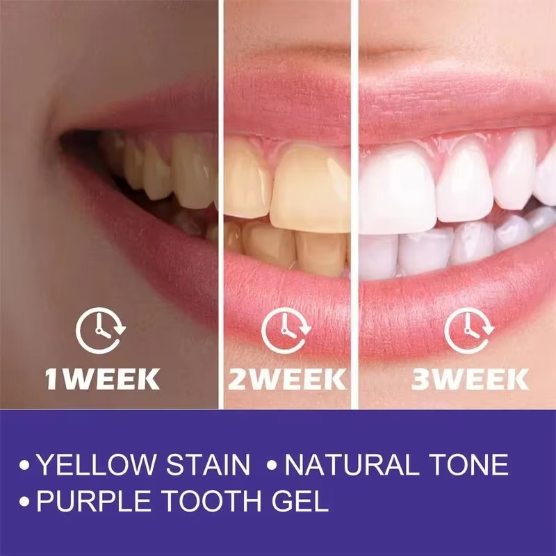 معجون أسنان مبيض لتنظيف الأسنا - مراجعة Teeth Whitening In Korea وسعره